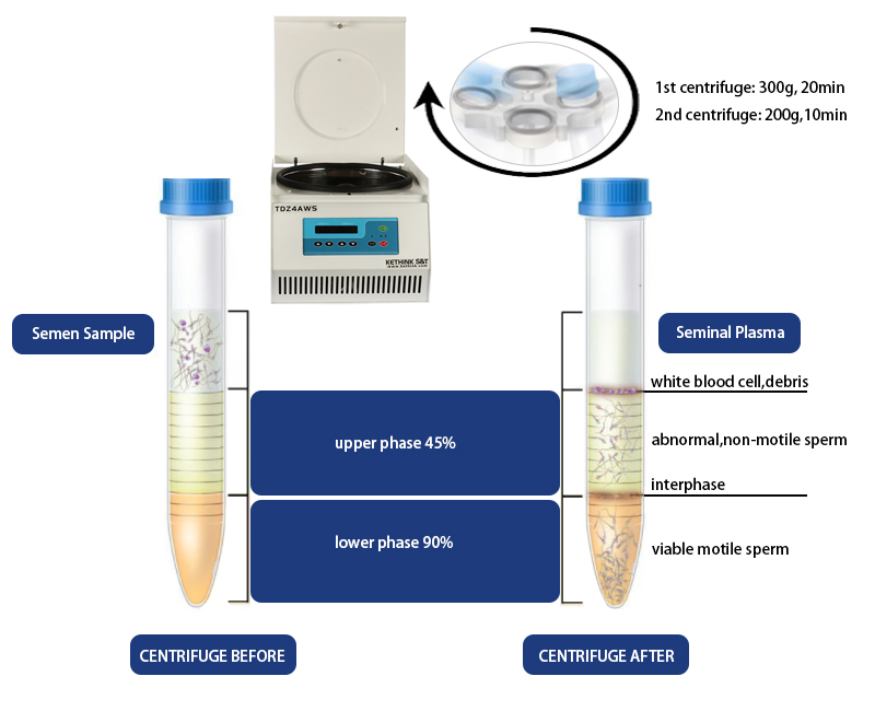 Puresperm Density Gradient Centrifugation