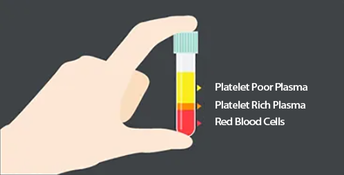 Blood Centrifugation